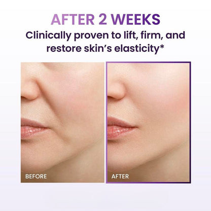 Zymera Probioderm Lifting Cream